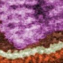 Ausschnitt Grippe-Virus - Public Domain